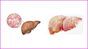 ANATOMY HUMAN LIVER