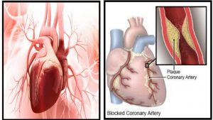 7 HEART ATTACK SIGNS NOT TO IGNORE