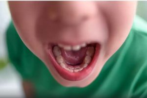 worst food for child teeth